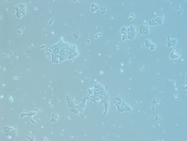 ActiCells™ GMP-Matching RUO hiPSCs (CD34<sup>+</sup> Cord Blood Cells, Normal, Male)