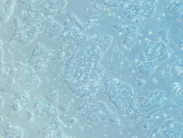 ActiCells™ GMP hiPSCs (CD34<sup>+</sup> Cord Blood Cells, Normal, Male)