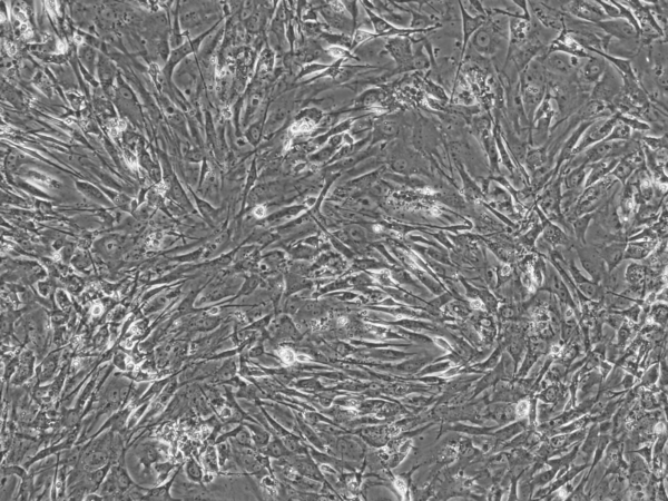 CF-1 MEF Feeder Cells, P3, Irradiated