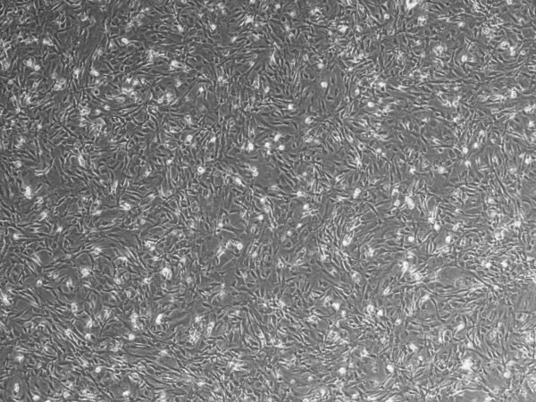 DR4 MEF Feeder Cells, P2, Untreated