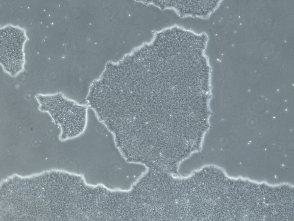 Human iPSCs From PBMCs (Normal, Male, Caucasian, Adult)