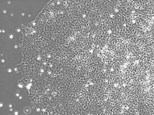 Human iPSCs From Fibroblasts (Normal, Female, Caucasian, Adult)