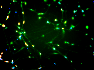 iPSC-Derived Dopaminergic Neurons With Media
