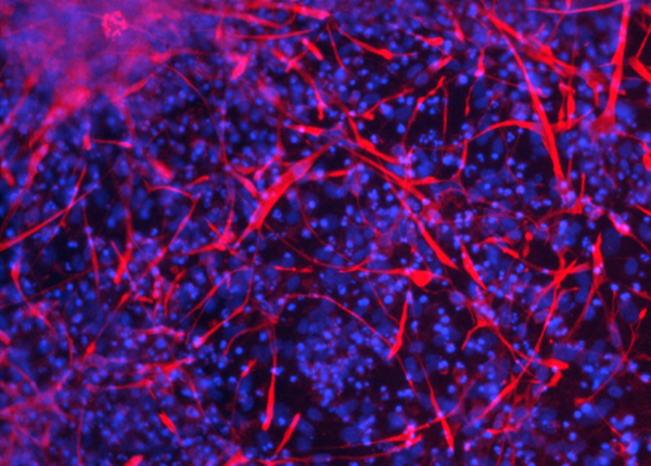 iPSC-Derived Neural Progenitor Cells (NPC) With Media