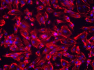 iPSC-Derived Cardiomyocytes With Media