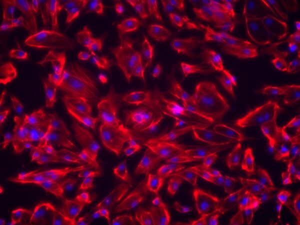 iPSC-Derived Cardiomyocytes With Media