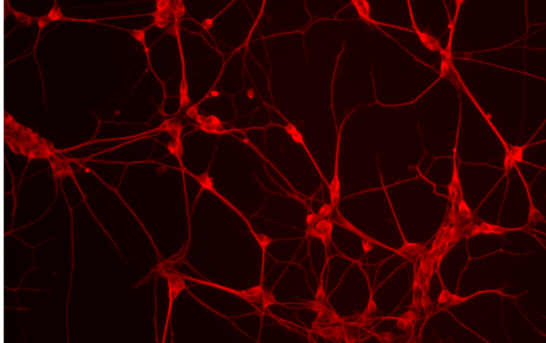 iPSC-Derived Motor Neurons With Media