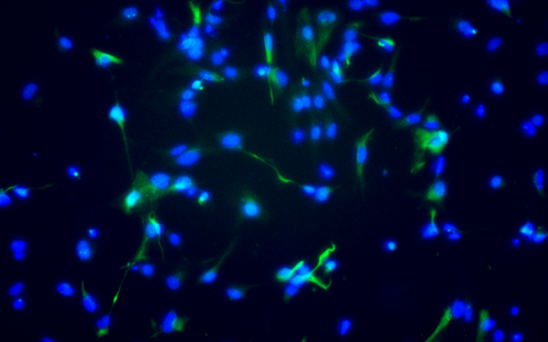iPSC-Derived Photoreceptor Progenitor Cells With Media