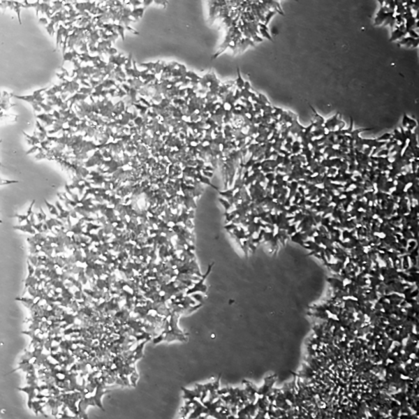 Brightfield microscope image of AST-9650 hiPSCs