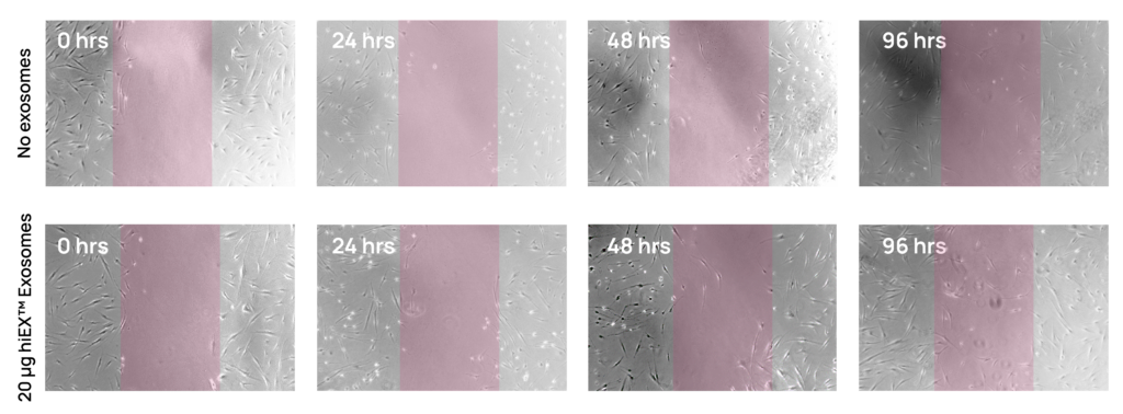Eight brightfield micrographs with translucent red rectangles of the same width.