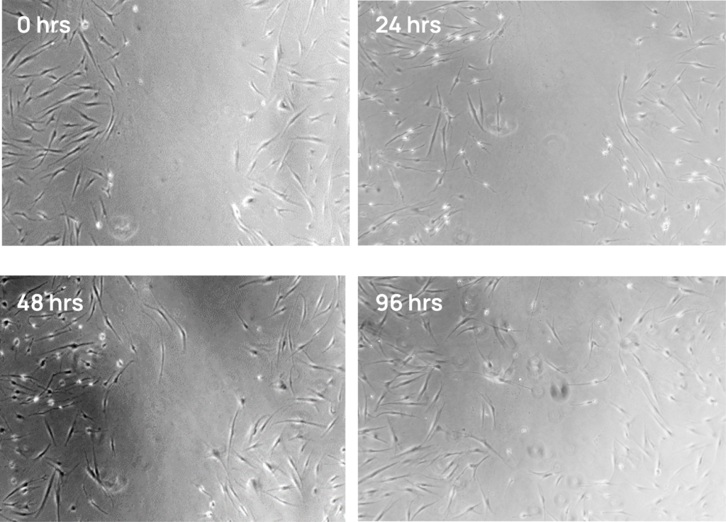 Four panel microscope images of dermal fibroblasts treated with hiEX exosomes