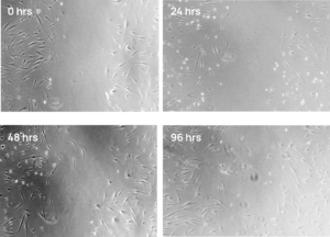 Four panel microscope images of dermal fibroblasts treated with hiEX exosomes