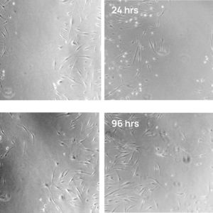 Four panel microscope images of dermal fibroblasts treated with hiEX exosomes
