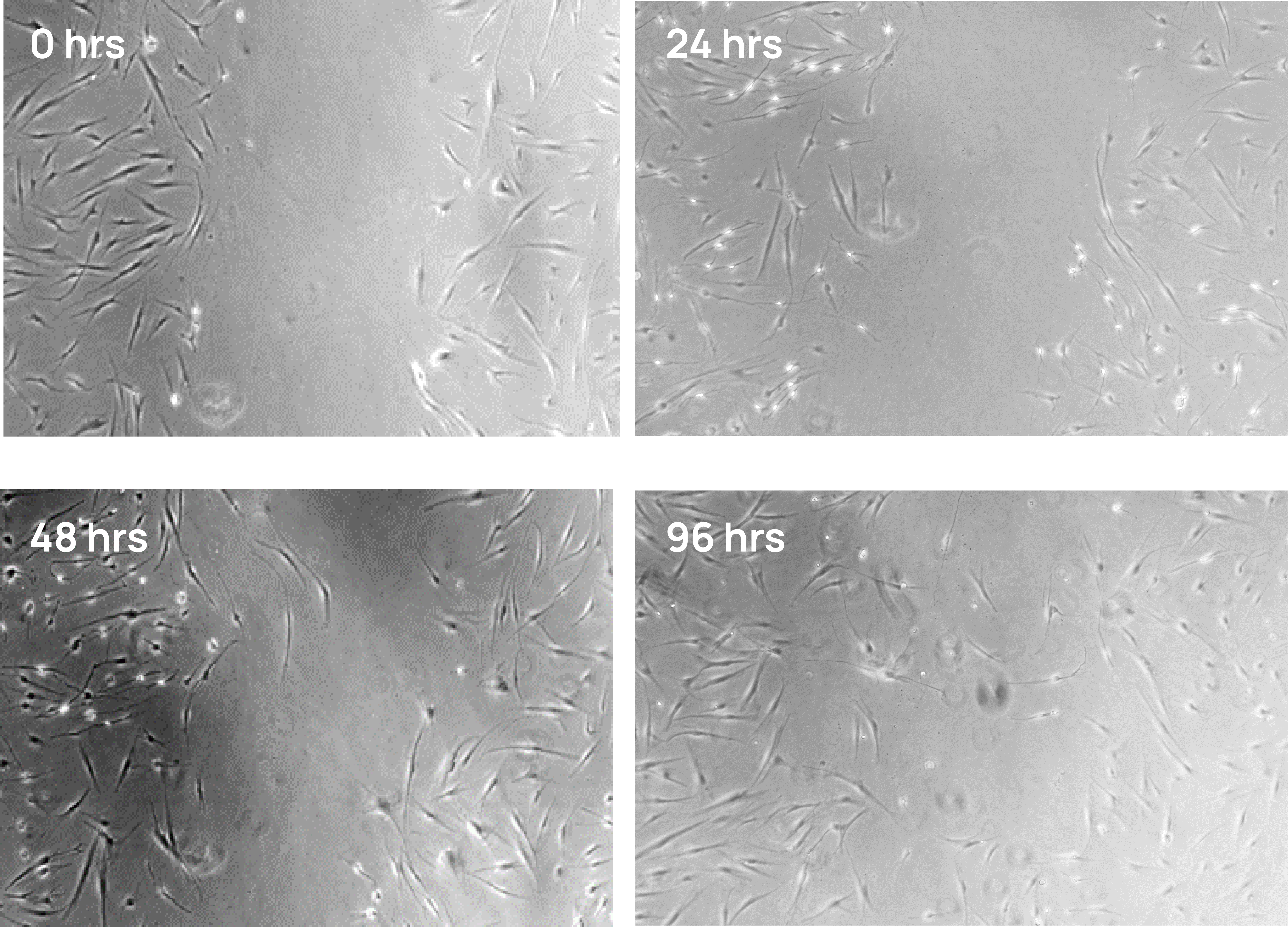 Four panel microscope images of dermal fibroblasts treated with hiEX exosomes