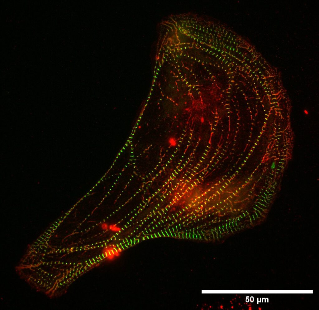 Immunofluorescent microscopy image showing red, green, and yellow dots.